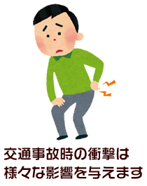交通事故時の衝撃は様々な影響を与えます